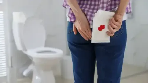 Why Do I Pass Blood in Stool Without Pain?